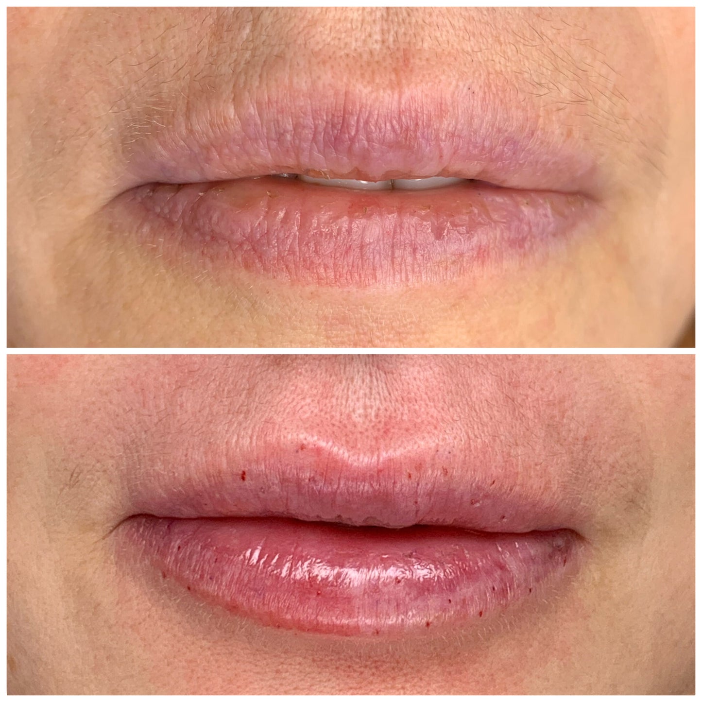 Be.U 4 Lips (recuperação e hidratação de lábios)-Programa Lábios Perfeitos