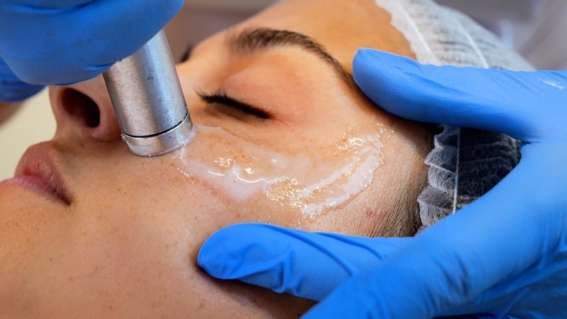 Be.U Xpress- Hidratação com ácido hialurónico (Pés de galinha, bigode chinês, terço superior, terço médio, terço inferior, colo e mãos)