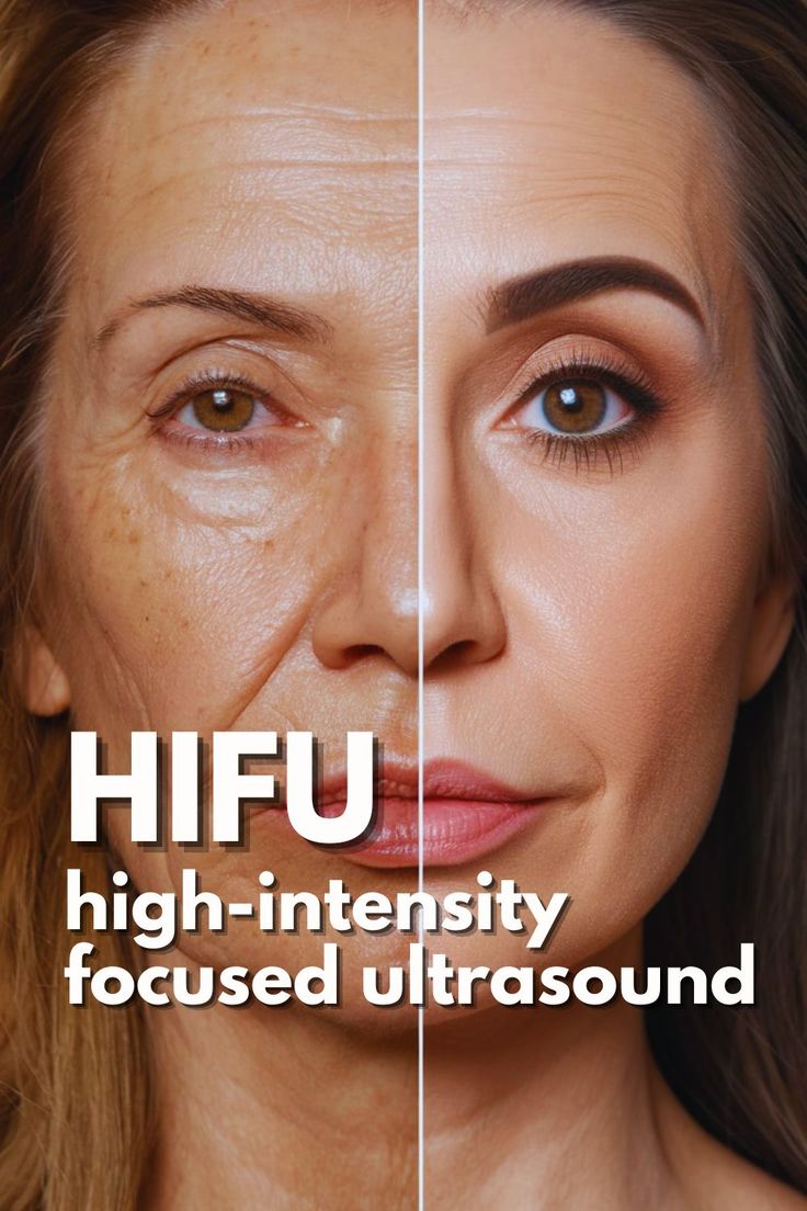 BeU Pack HIFU Regeneration